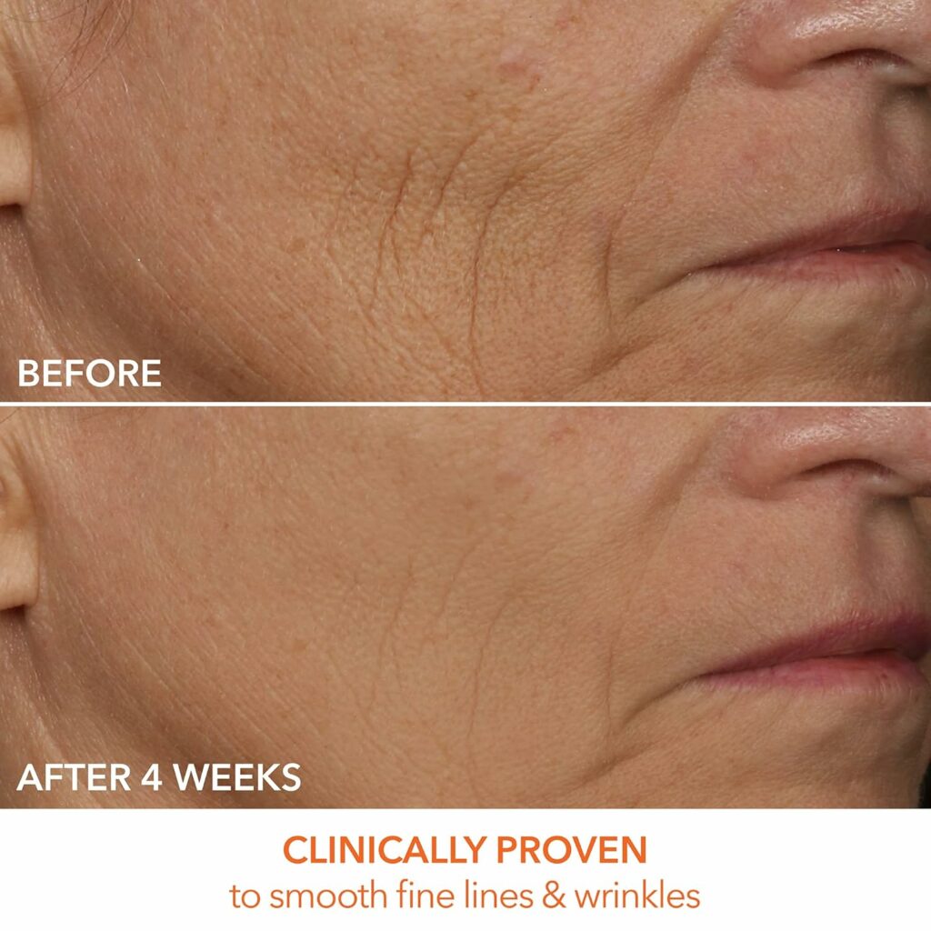 Dr. Dennis Gross DRx SpectraLite FaceWare Pro clinical proven